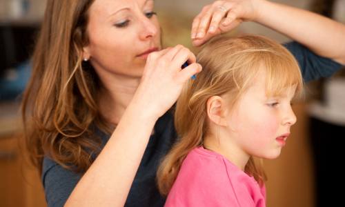 checking your kids for head and body lice for school